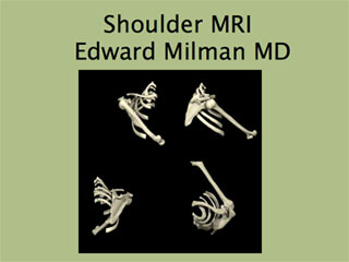 Arthrogram