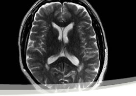 MRI Wayne NJ
